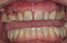 Cosmetic Dentistry