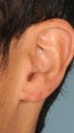 Ear Gauge Repair