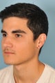 Gauged Earlobe Repair