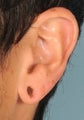 Ear Gauge Repair