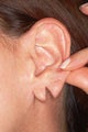 Earlobe Repair
