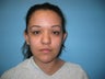 Otoplasty