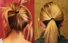Otoplasty or ear push back surgery