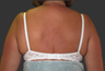 Exilis
