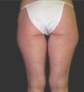 Exilis