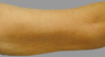 Exilis