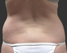 Exilis