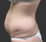 Exilis