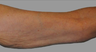 Exilis