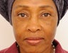 Lower Blepharoplasty (Lower Eyelids)