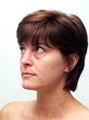 Eyelid Surgery
