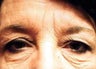 Eyelid Enhancement