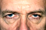 Eyelid Surgery