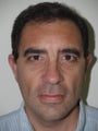 Facelift/Chin Implant