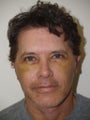 Facelift and Upper Blepharoplasty