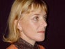 Face Lift, endosopic brow lift, eyelid lift.