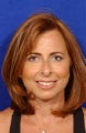 Facelift, necklift, upper blepharoplasty