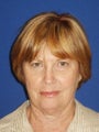 Facelift, Endoscopic Browlift, Upper and Lower Blepharoplasty, Perioral Dermabrasion