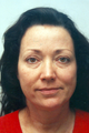 Facelift