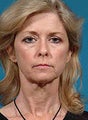 Facelift