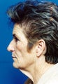 Facelift