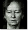 Facelift