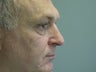 Extended lower lid blepharoplasty