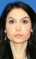 Full Face Fat Transfer