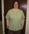 Gastric Bypass