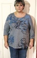 Gastric Bypass 