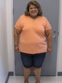Gastric Bypass