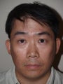 Hair Transplant 