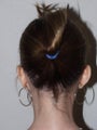 Hair Tansplant