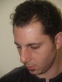 Before and After Rhinoplasty and Hair Transplant Procedures