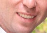 Invisalign
