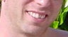 Invisalign