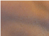 laser hair removal 