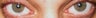 Laser Eye Surgery