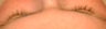 Latisse for eyelashes