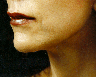 Lip Enhancement