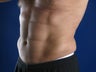 VASER assisted hi definition liposuction