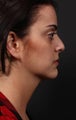 Liposuction of the neck