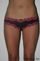 Liposuction