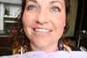 Veneers 