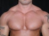 Male Breast Reduction