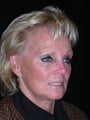 Forehead reconstruction following MOHS surgery for skin cancer