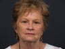 65 year old female with facial aging.