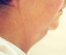 Necklift