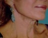 Neck Lift