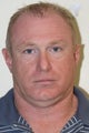 neck lift, neck liposuction, lower bleph